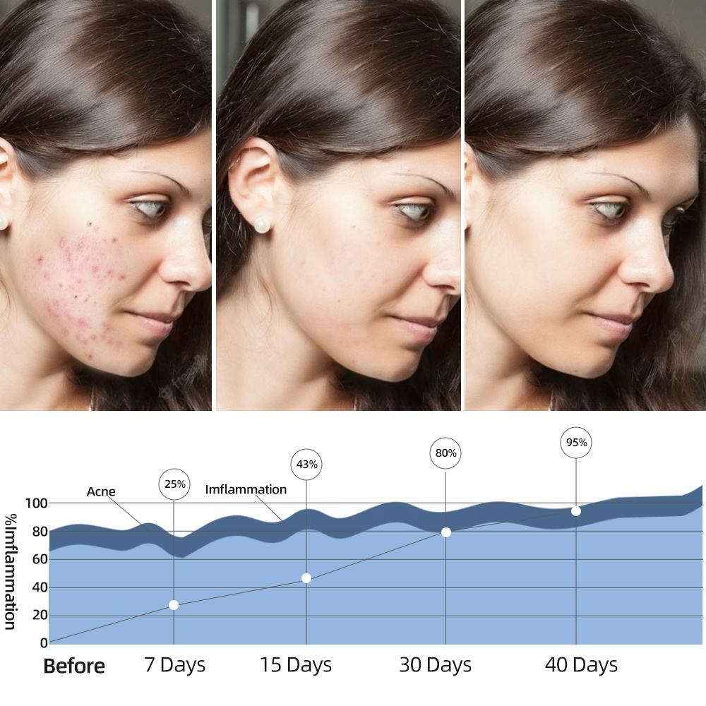 7-Color LED Photon Facial Mask-Personal Care Appliances-Splashis-Splashis