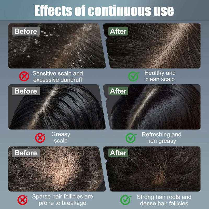 Vibrating scalp massage comb with light — additional view 7