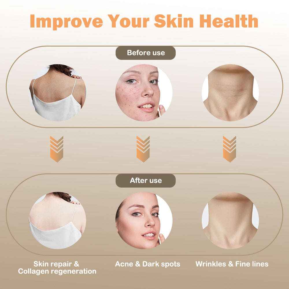 LED Photon Therapy Skin Rejuvenation-Personal Care Appliances-Splashis-Splashis
