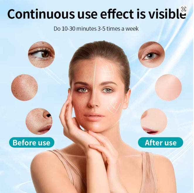 Multi-color LED facial light device — additional view 3